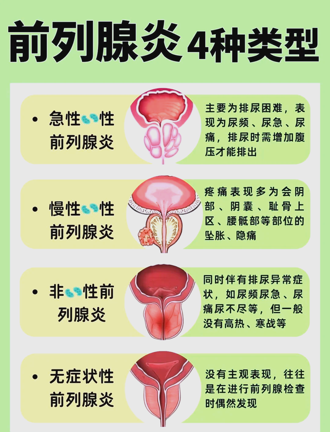 前列腺炎的分类，你是哪种？